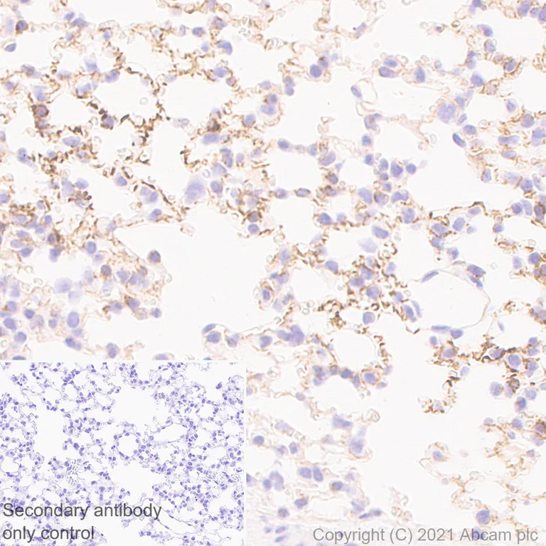 Immunohistochemistry (Formalin/PFA-fixed paraffin-embedded sections) - Anti-CXCR4 antibody [UMB2] (AB124824)