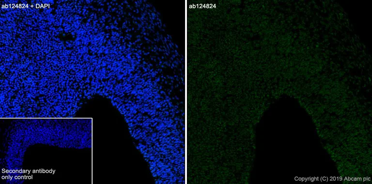 Immunohistochemistry (Frozen sections) - Anti-CXCR4 antibody [UMB2] (AB124824)