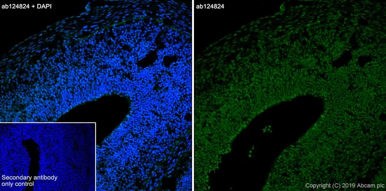Immunohistochemistry (Frozen sections) - Anti-CXCR4 antibody [UMB2] (AB124824)