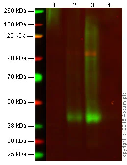 Western blot - Anti-CXCR4 antibody [UMB2] (AB124824)