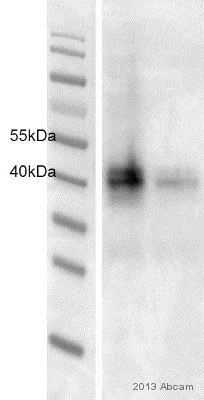 Western blot - Anti-CXCR4 antibody [UMB2] (AB124824)