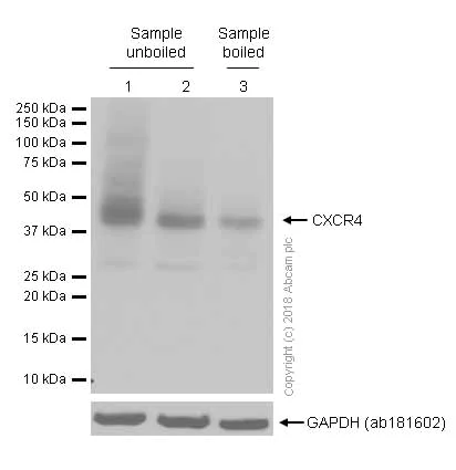 Western blot - Anti-CXCR4 antibody [UMB2] (AB124824)