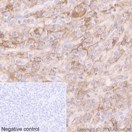 Immunohistochemistry (Formalin/PFA-fixed paraffin-embedded sections) - Anti-CXCR4 antibody [UMB2] - BSA and Azide free (AB197203)