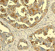 Immunohistochemistry (Formalin/PFA-fixed paraffin-embedded sections) - Anti-CXCR4 antibody [UMB2] - BSA and Azide free (AB197203)