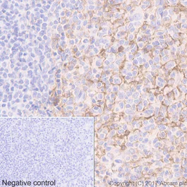 Immunohistochemistry (Formalin/PFA-fixed paraffin-embedded sections) - Anti-CXCR4 antibody [UMB2] - BSA and Azide free (AB197203)