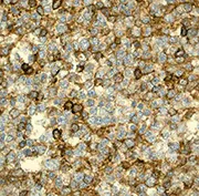 Immunohistochemistry (Formalin/PFA-fixed paraffin-embedded sections) - Anti-CXCR4 antibody [UMB2] - BSA and Azide free (AB197203)