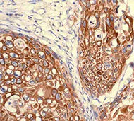 Immunohistochemistry (Formalin/PFA-fixed paraffin-embedded sections) - Anti-CXCR4 antibody [UMB2] - BSA and Azide free (AB197203)