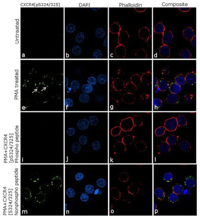 Immunocytochemistry/ Immunofluorescence - Anti-CXCR4 (phospho S324 + S325) Antibody [RP23040164] (AB313465)