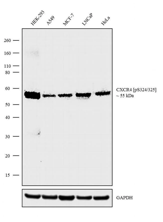 Western blot - Anti-CXCR4 (phospho S324 + S325) Antibody [RP23040164] (AB313465)
