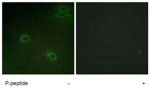 Immunocytochemistry/ Immunofluorescence - Anti-CXCR4 (phospho S339) antibody (AB74012)