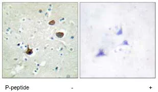 Immunohistochemistry (Formalin/PFA-fixed paraffin-embedded sections) - Anti-CXCR4 (phospho S339) antibody (AB74012)