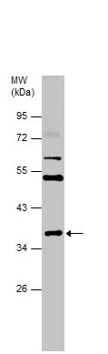 Western blot - Anti-cxcr4b antibody - N-terminal (AB229623)