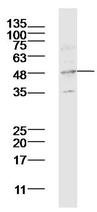 Western blot - Anti-CXCR5 antibody (AB203212)