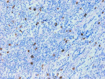 Immunohistochemistry (Formalin/PFA-fixed paraffin-embedded sections) - Anti-CXCR5 antibody (AB46218)
