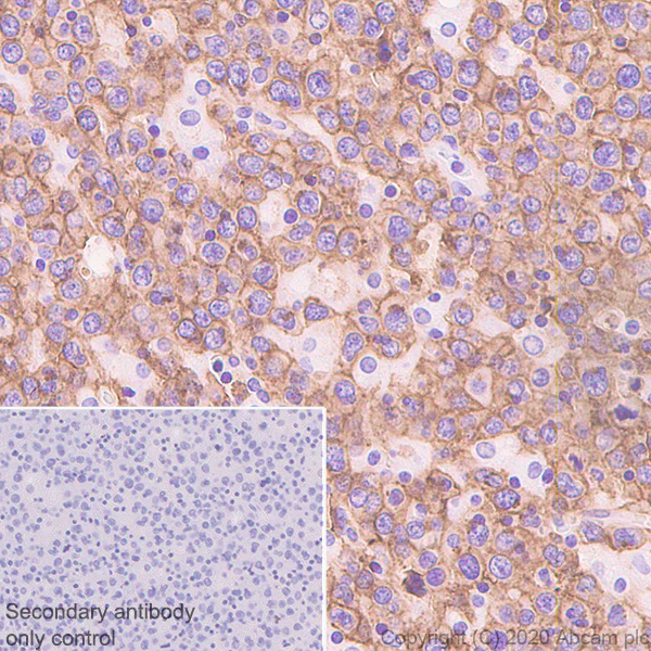 Immunohistochemistry (Formalin/PFA-fixed paraffin-embedded sections) - Anti-CXCR5 antibody [EPR23463-30] (AB254415)
