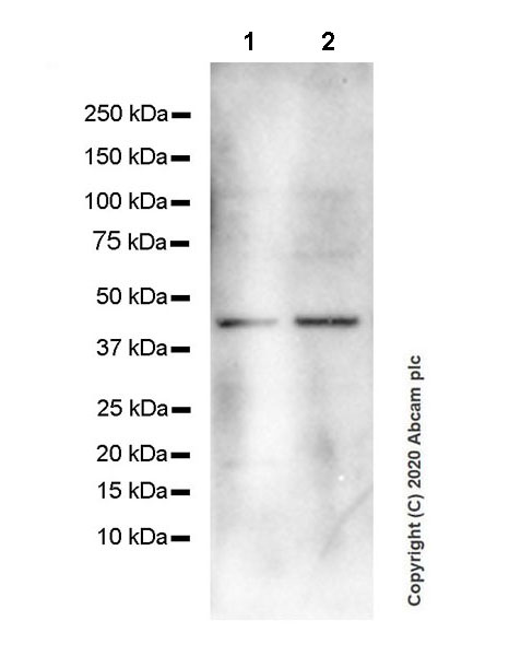 Western blot - Anti-CXCR5 antibody [EPR23463-30] (ab254415), expandable thumbnail