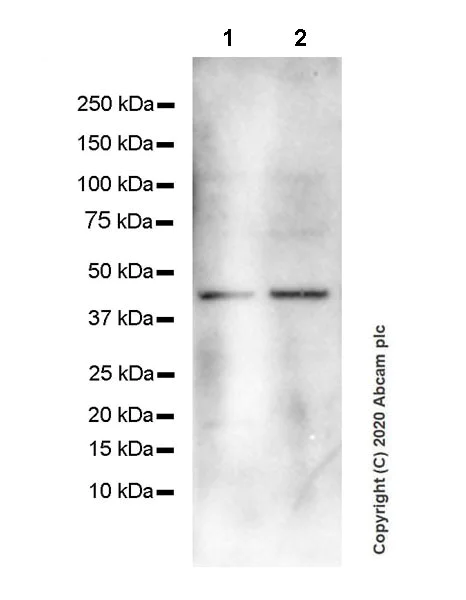 Western blot - Anti-CXCR5 antibody [EPR23463-30] (AB254415)