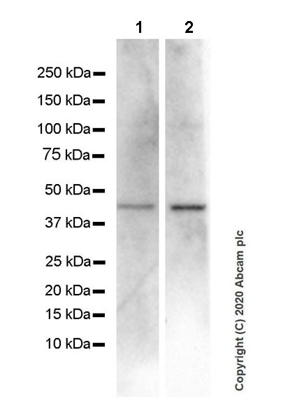 Western blot - Anti-CXCR5 antibody [EPR23463-30] (ab254415), expandable thumbnail