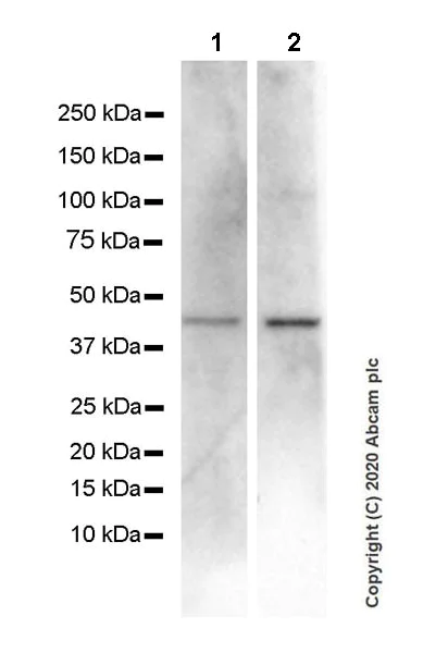 Western blot - Anti-CXCR5 antibody [EPR23463-30] (AB254415)