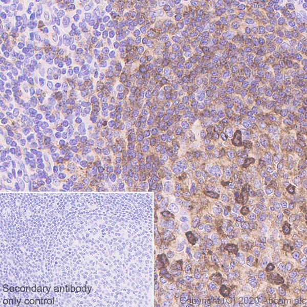 Immunohistochemistry (Formalin/PFA-fixed paraffin-embedded sections) - Anti-CXCR5 antibody [EPR23463-30] - BSA and Azide free (AB272936), expandable thumbnail