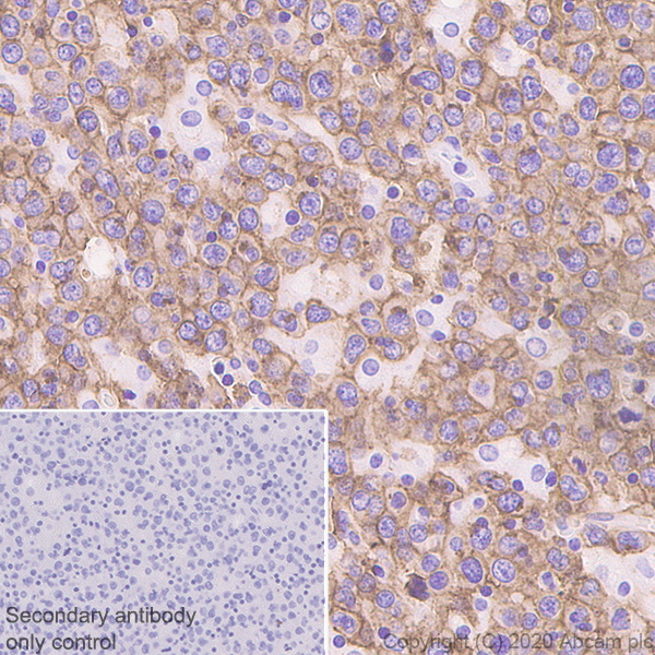 Immunohistochemistry (Formalin/PFA-fixed paraffin-embedded sections) - Anti-CXCR5 antibody [EPR23463-30] - BSA and Azide free (ab272936), expandable thumbnail