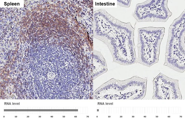 Immunohistochemistry (Formalin/PFA-fixed paraffin-embedded sections) - Anti-CXCR5 antibody [HL3708] - BSA and Azide free (AB325850)
