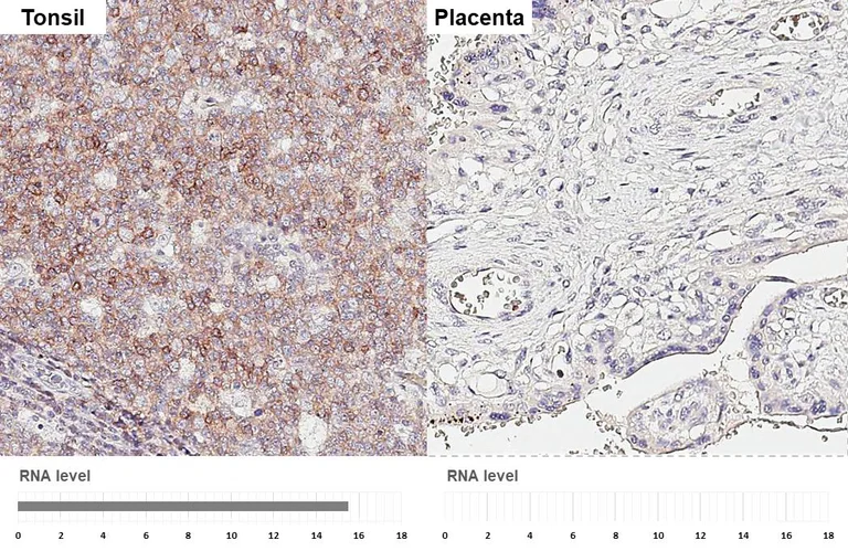 Immunohistochemistry (Formalin/PFA-fixed paraffin-embedded sections) - Anti-CXCR5 antibody [HL3708] - BSA and Azide free (AB325850)