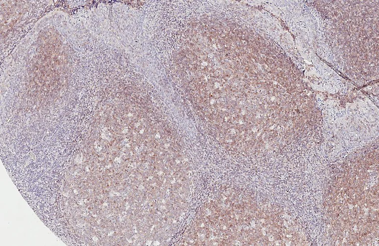 Immunohistochemistry (Formalin/PFA-fixed paraffin-embedded sections) - Anti-CXCR5 antibody [HL3708] - BSA and Azide free (AB325850)