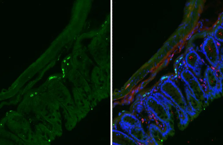 Immunohistochemistry (Frozen sections) - Anti-CXCR5 antibody [HL3708] - BSA and Azide free (AB325850)