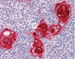 Immunohistochemistry (Formalin/PFA-fixed paraffin-embedded sections) - Anti-CXCR6 antibody (AB125115)