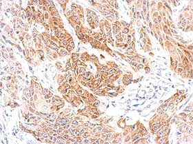 Immunohistochemistry (Formalin/PFA-fixed paraffin-embedded sections) - Anti-CXCR6 antibody (AB137344), expandable thumbnail