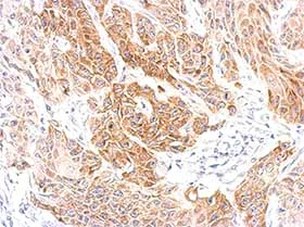 Immunohistochemistry (Formalin/PFA-fixed paraffin-embedded sections) - Anti-CXCR6 antibody (AB137344)