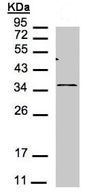 Western blot - Anti-CXCR6 antibody (AB137344), expandable thumbnail