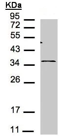 Western blot - Anti-CXCR6 antibody (AB137344)