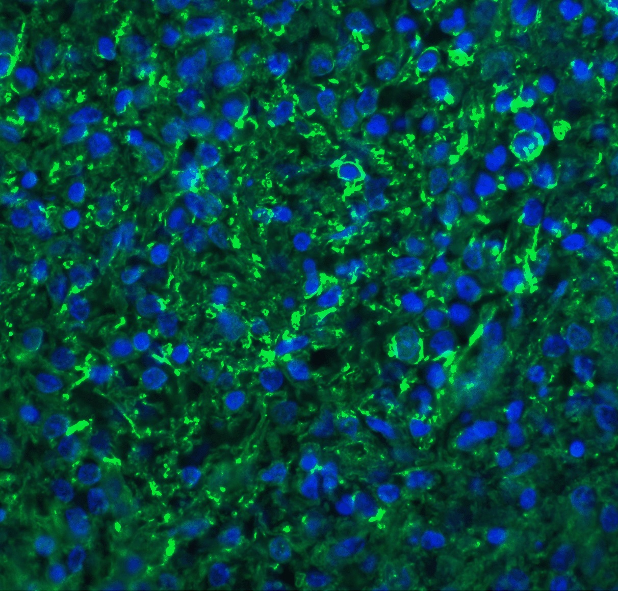 Immunofluorescence - Anti-CXCR6 antibody (AB8023), expandable thumbnail