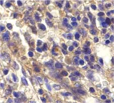 Immunohistochemistry (Formalin/PFA-fixed paraffin-embedded sections) - Anti-CXCR6 antibody (AB8023)