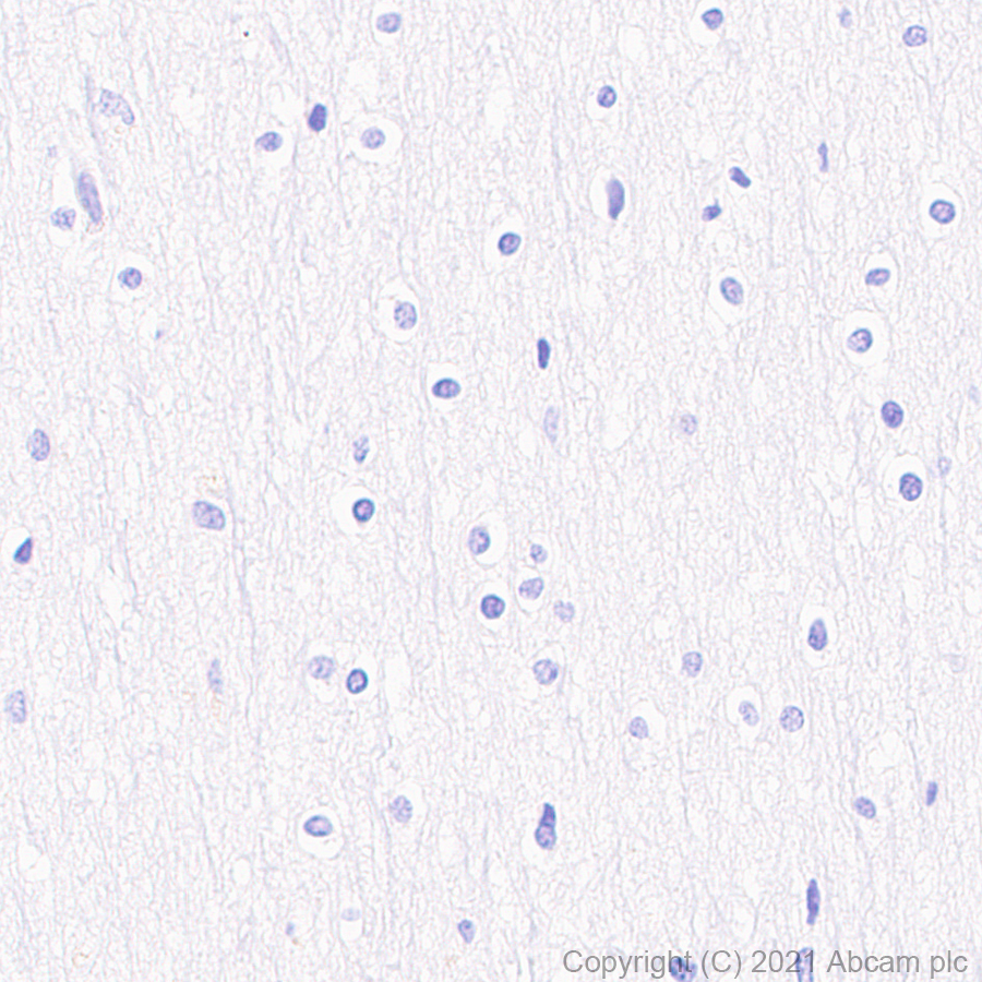 Immunohistochemistry (Formalin/PFA-fixed paraffin-embedded sections) - Anti-CXCR6 antibody [EPR24686-113] (AB273116)