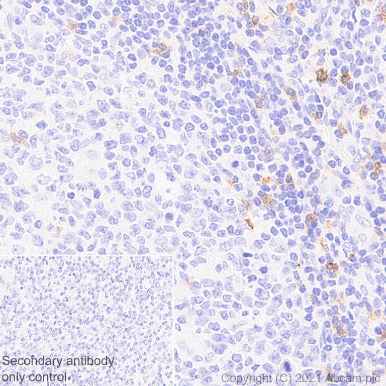 Immunohistochemistry (Formalin/PFA-fixed paraffin-embedded sections) - Anti-CXCR6 antibody [EPR24686-113] - BSA and Azide free (AB281934)
