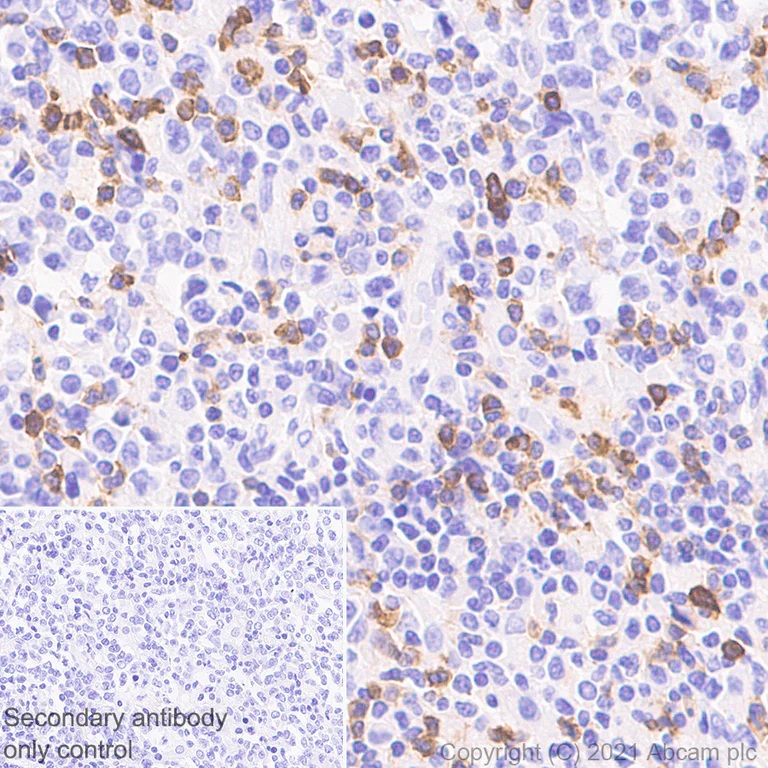 Immunohistochemistry (Formalin/PFA-fixed paraffin-embedded sections) - Anti-CXCR6 antibody [EPR24686-113] - BSA and Azide free (AB281934)