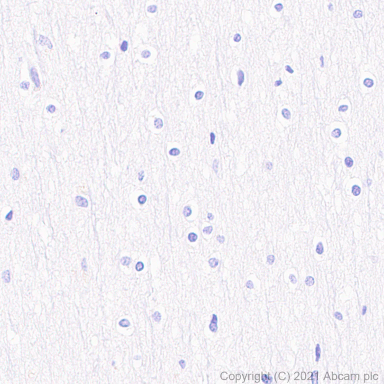 Immunohistochemistry (Formalin/PFA-fixed paraffin-embedded sections) - Anti-CXCR6 antibody [EPR24686-113] - BSA and Azide free (AB281934)