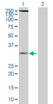 Western blot - CXCR6 overexpression 293T lysate (whole cell) (AB94068)