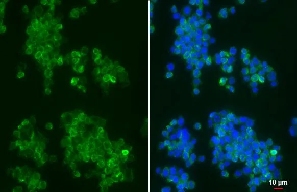 Immunocytochemistry/ Immunofluorescence - Anti-CXCR7 antibody [HL2189] (AB317157)
