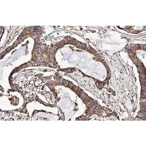 Immunohistochemistry (Formalin/PFA-fixed paraffin-embedded sections) - Anti-CXCR7 antibody [HL2189] (AB317157)