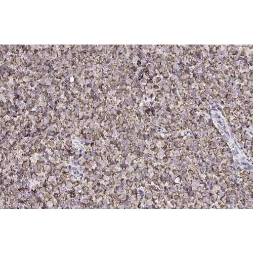 Immunohistochemistry (Formalin/PFA-fixed paraffin-embedded sections) - Anti-CXCR7 antibody [HL2189] (AB317157)