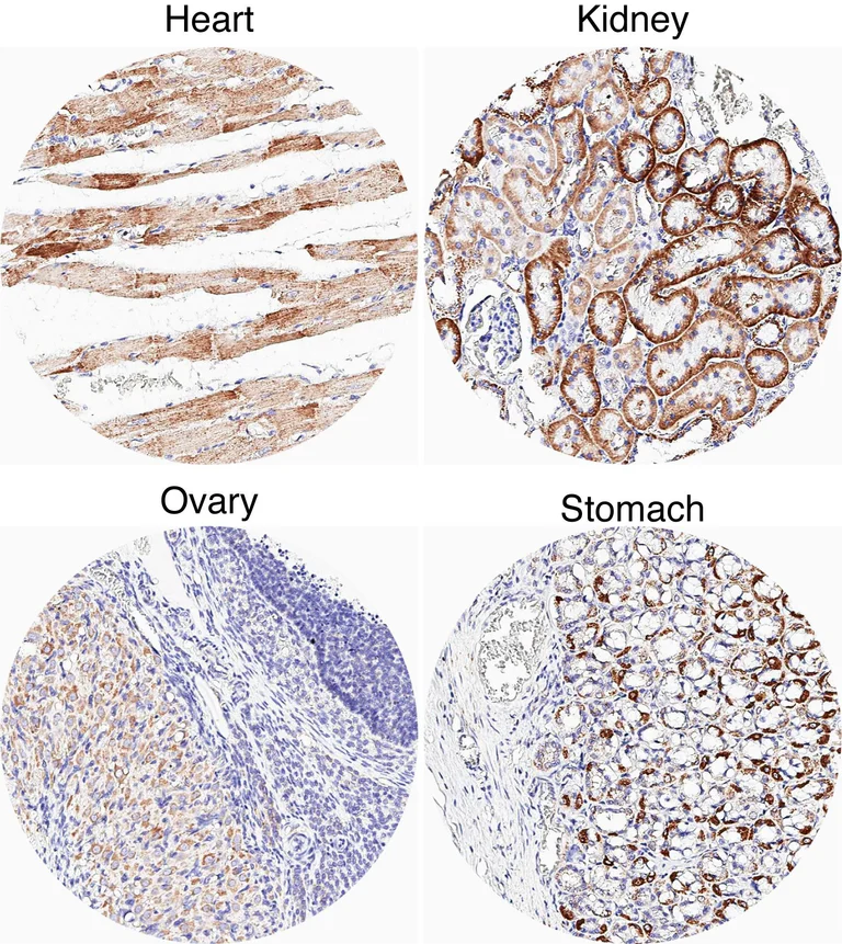 Immunohistochemistry (Formalin/PFA-fixed paraffin-embedded sections) - Anti-CXCR7 antibody [HL2189] (AB317157)