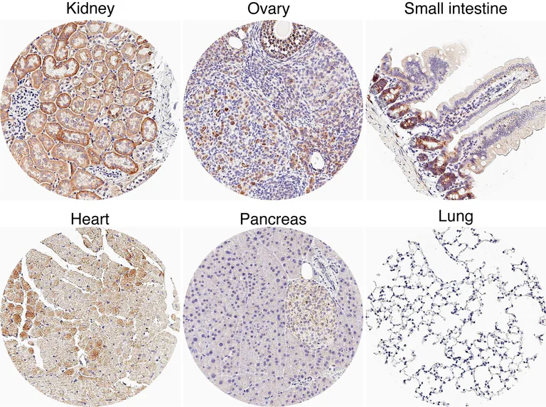 Immunohistochemistry (Formalin/PFA-fixed paraffin-embedded sections) - Anti-CXCR7 antibody [HL2189] (AB317157)