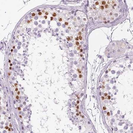 Immunohistochemistry (Formalin/PFA-fixed paraffin-embedded sections) - Anti-CXorf20 antibody (AB204795)