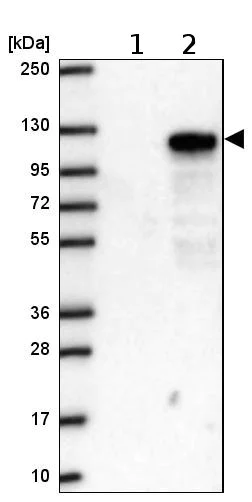 Western blot - Anti-CXorf20 antibody (AB204795)