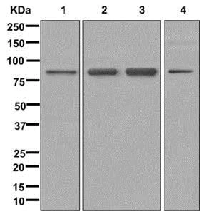 Western blot - Anti-CXorf23 antibody [EPR12942] (AB179446)