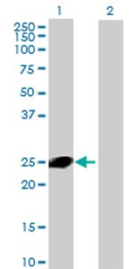 Western blot - Anti-CXorf48 antibody (AB69317)
